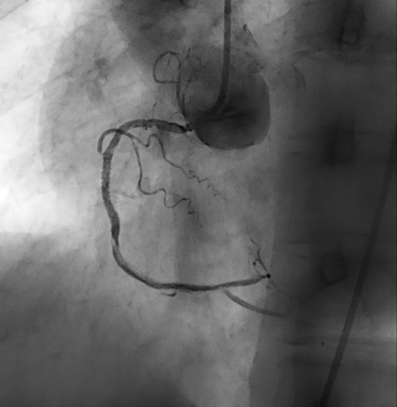 X-ray image cervical spine after ContextVision Image Enhancement