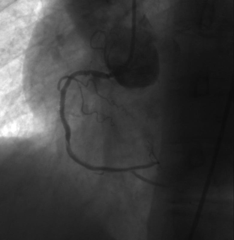 X-ray image cervical spine before ContextVision Image Enhancement